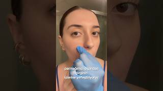 Gülme Çizgileri İçin Mutlaka Uygula