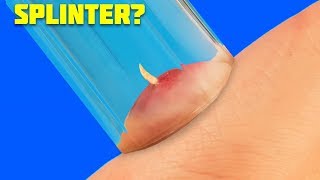 Hi guys. in this video, i will show you life hacks just make your
easier. learn how to cool coca-cola with a balloon, get rid of
splin...