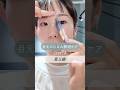 『目元のたるみ解消』⑵眉三線