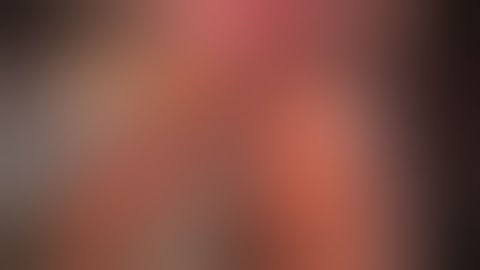 How to do a Lap Left Lateral Liver Sectionectomy in 5 Easy Steps (Narrated Version)