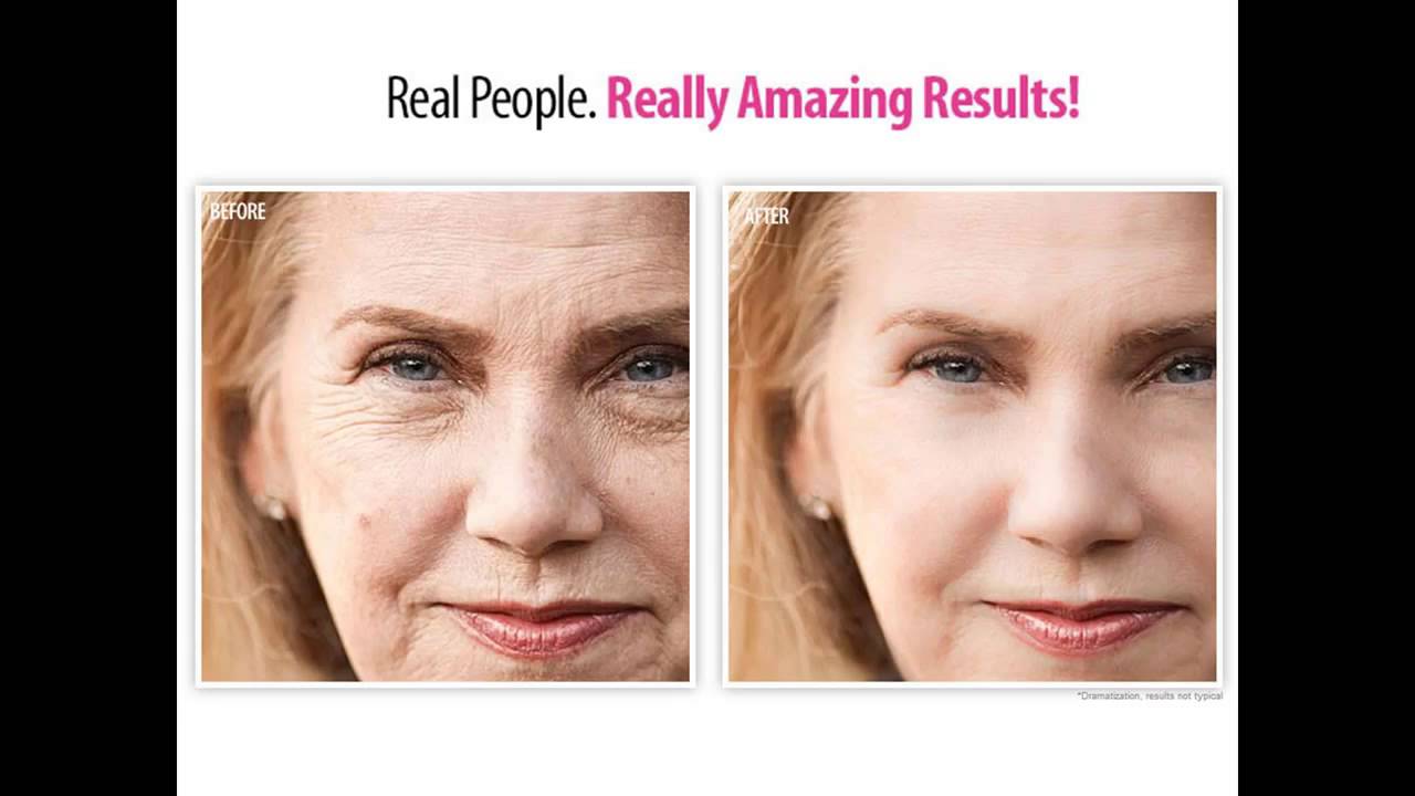 natural face lift cream