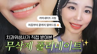 무삭제 라미네이트, 치과위생사가 직접 받은 과정&amp;후기!