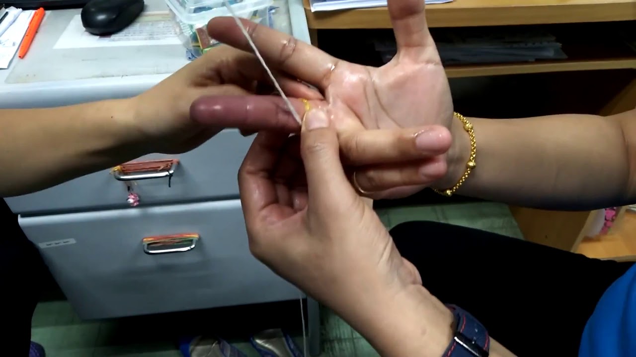 แหวนติดนิ้วเอาไม่ออกไงดี ทำทุกวิธีแล้ว ลองดูวิธีนี้ Remove A Ring From A Swollen Finger - YouTube