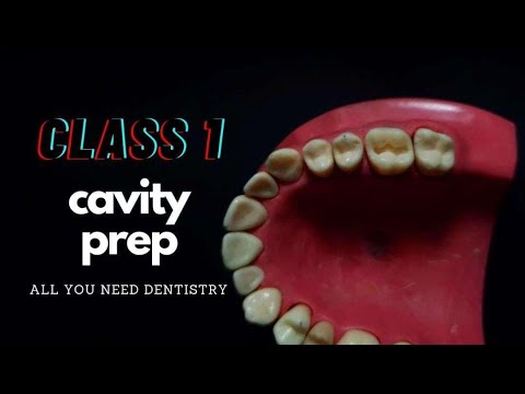 Class II cavity preparation for amalgam - mandibular molar #36 -  Preclinical Operative - Arabic عربي 