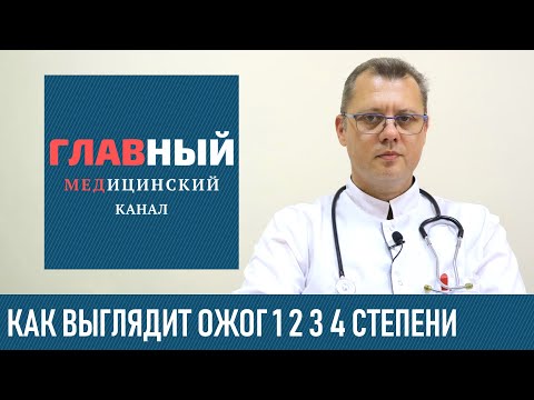 Как выглядит ОЖОГ 1 2 3 и 4 степени (фото 1-3). Классификация ожогов по глубине и степени тяжести