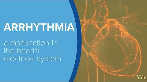 Heart Arrhythmia – Yale Medicine Explains