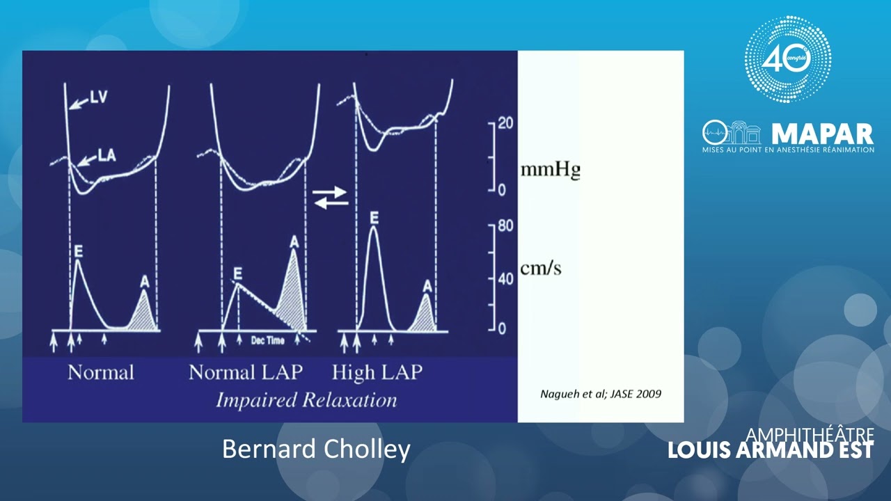 Que faire de la fonction diastolique dans ma pratique ?
