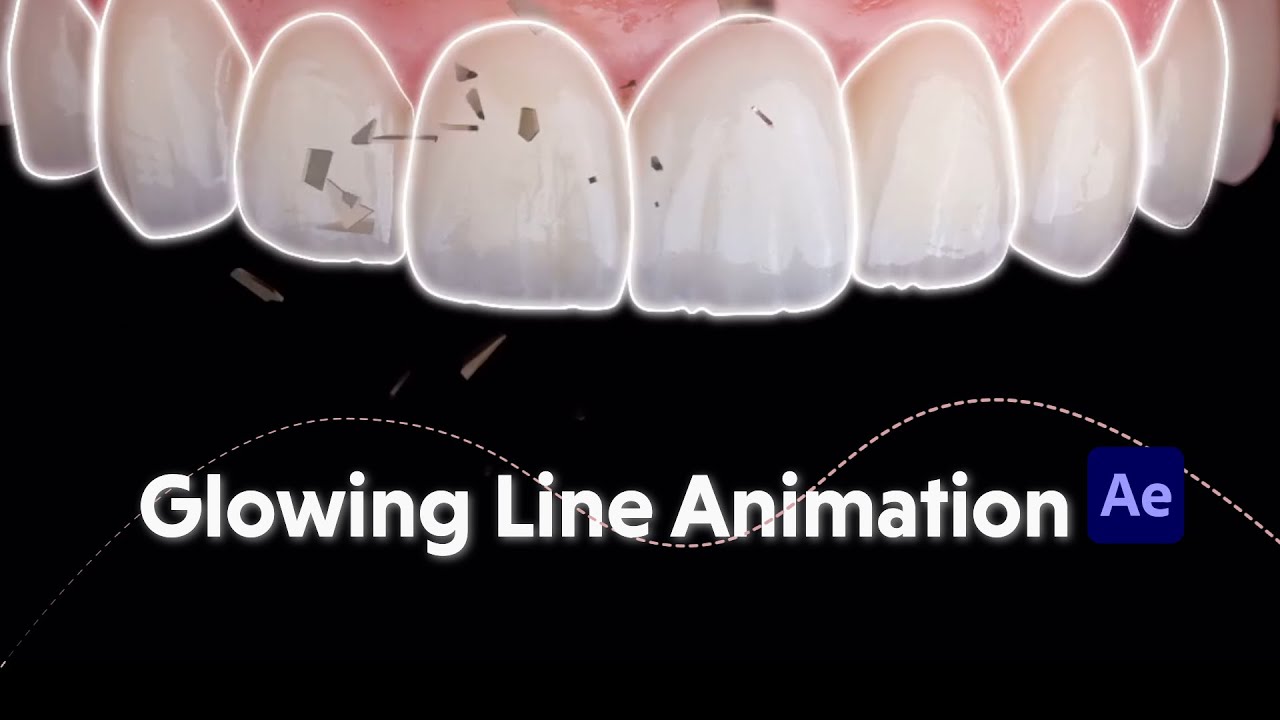 Dental motion graphics - glowing line animation around teeth - YouTube