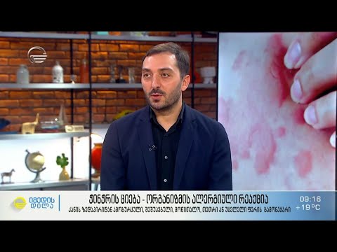 ჭინჭრის ციება - ორგანიზმის ალერგიული რეაქცია, სიმპტომები, მიზეზები და მკურნალობის გზები