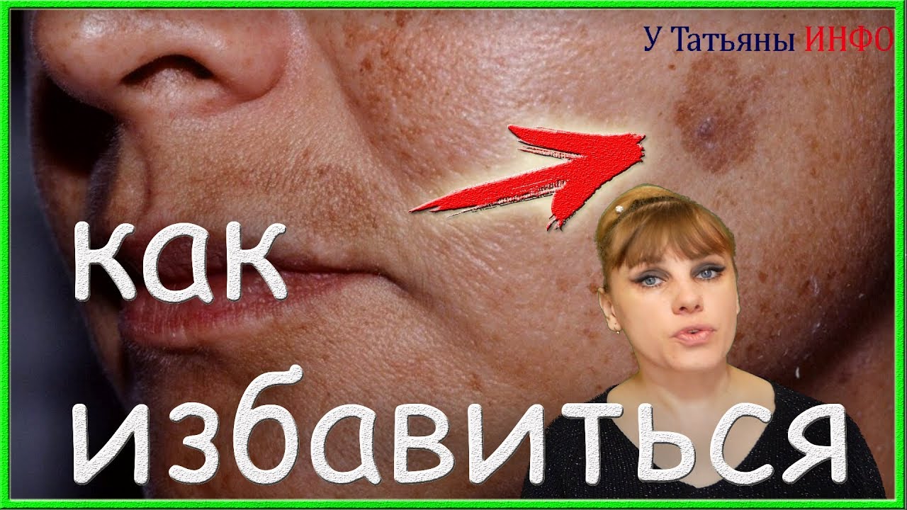 Как вырастить розу из черенка в домашних условиях 90 Как вырастить розу из черенка в домашних условиях 97