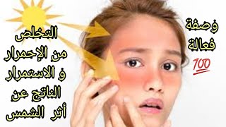 قناع لإزالة حروق الشمس بدون استعمال واقي شمسي ️ من أول إستعمال  ️