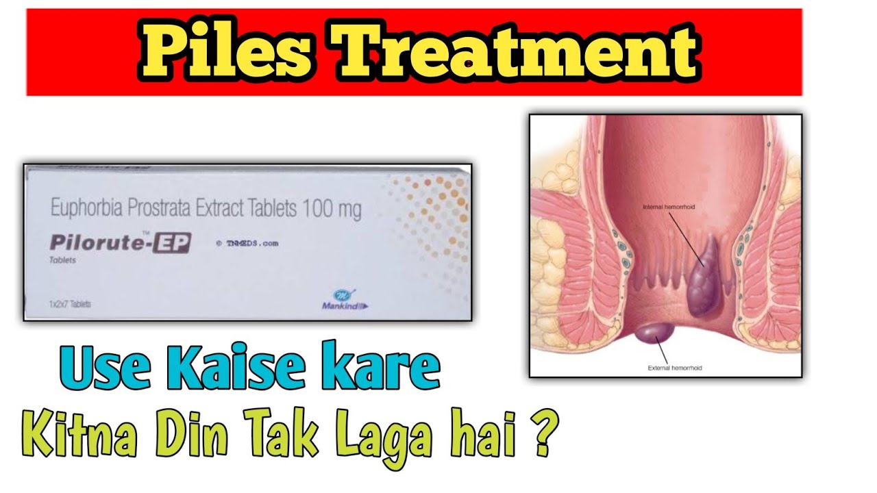 Pilorut EP Cream Used In Hindi ! Piles Treatment ! Use Kaise kare