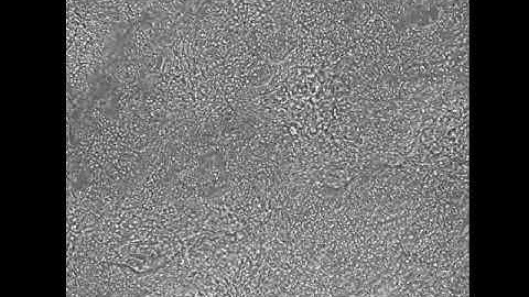 Video Cardiomyocytes