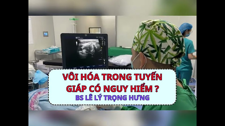 Vôi hóa tuyến giáp có nguy hiểm không năm 2024