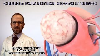 MIOMECTOMIA - CIRURGIA PARA RETIRAR MIOMAS DO ÚTERO