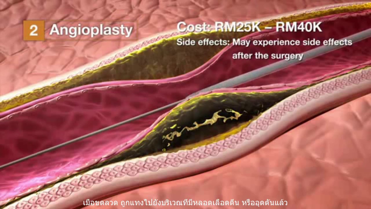 The Power of Nitric Oxide - YouTube