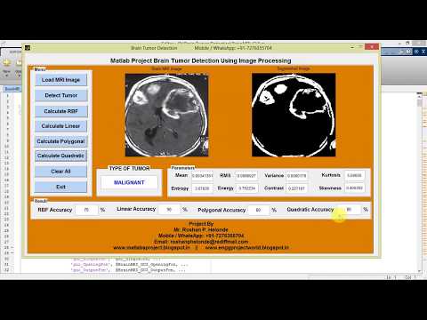 Brain Tumor Detection and Classification Using Matlab Project Code