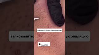 #эпиляция дарим 10 000₽ по ссылке в шапке профиля👉🏻