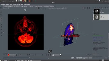 Aliza  / Aliza MS DICOM Viewer. Anchor tool.