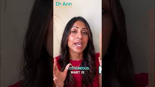 What Exactly Is a Wart? | Doctor Explains #warts