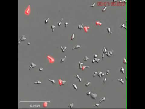 Video: Angiogeneza Defectuoasă La șoarecii Mutanți CXCL12 Afectează Regenerarea Mușchilor Scheletici