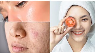 3 days & all open pores will disappear from your skin |Tomato Scrub for skin Whitening  #beautytails