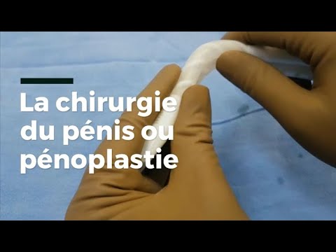 Vidéo: Chirurgie D'agrandissement Du Pénis: Coût, Risques Globaux, Efficacité