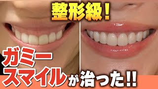 ⚠裁断済み　ガミースマイル : 11の要因 成功に導くトリートメントマップ ガミースマイル: 11の要因 成功に導くトリートメントマップ