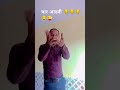 एक बार मैंने#trending #funny #ajay #comedy #short #video 😜😜😂😂😂