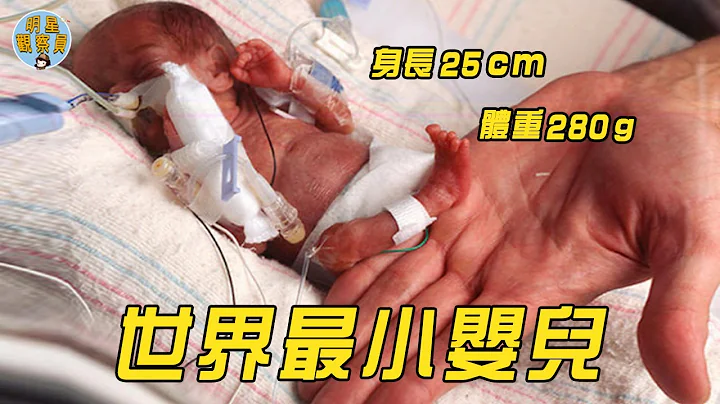 全世界最小的婴儿，只有25cm体重280g，医生说她活不到1岁｜拇指姑娘｜明星观察员 - 天天要闻