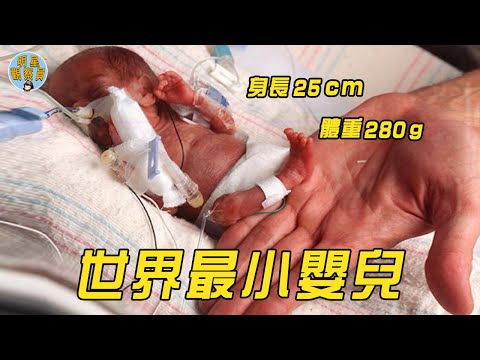 全世界最小的嬰兒，只有25cm體重280g，醫生說她活不到1歲｜拇指姑娘｜明星觀察員