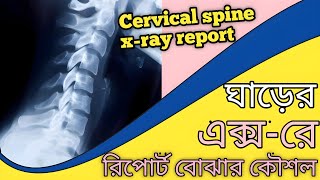 cervical spine x ray report in Bengali | Tips for understanding neck x ray report screenshot 4