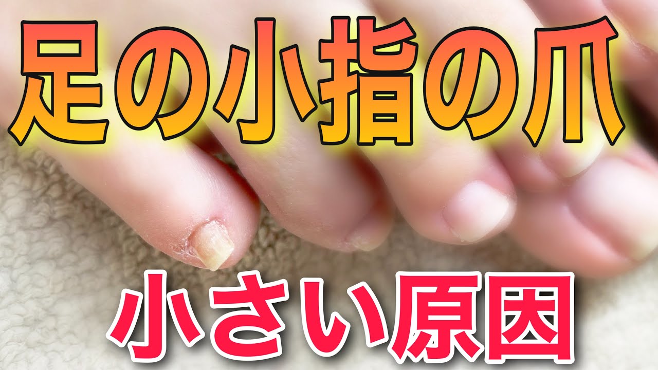 足の小指の爪が小さい原因 Wakaさんのブログ Cosme アットコスメ