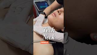 Tech neck lines treatment 🤯⚡️#yyc #calgary #yyclocal #yycbuzz #yycliving