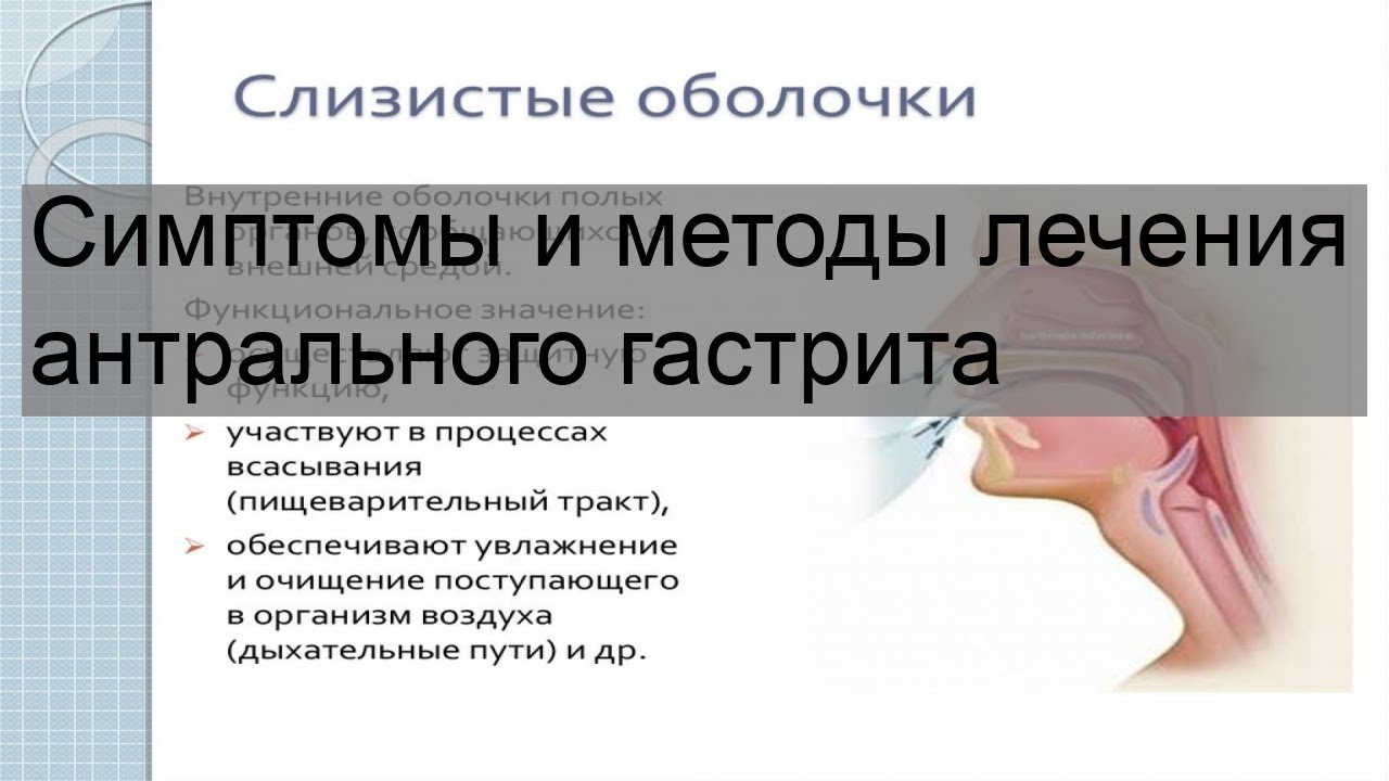 Симптомы и методы лечения антрального гастрита