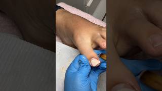 Acrylic on big toe #beginnerfriendly #acrylictoes #acrylicapplication #nailinspo
