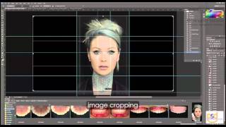 Smile Design Process - Dr. Angelo Lazaris, Sydney Cosmetic Dentist