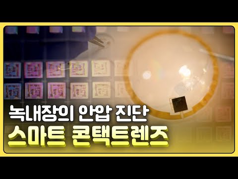 [황금나침반] 녹내장 환자의 안압을 실시간 모니터링하는 스마트 콘택트렌즈 / YTN 사이언스