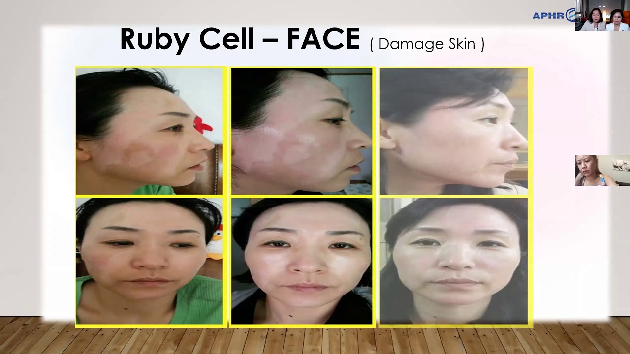 Beauty business using stem cell - Chinese Brand Day Ruby-Cell - Sharon ...