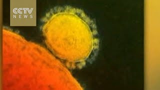 Chinese, US scientists develop MERS antibody