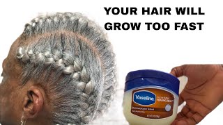 😳 Broke The Internet In 24 Hoursthis Hair Growth Recipe With Vaseline Grows Hair 10X Faster N Thick