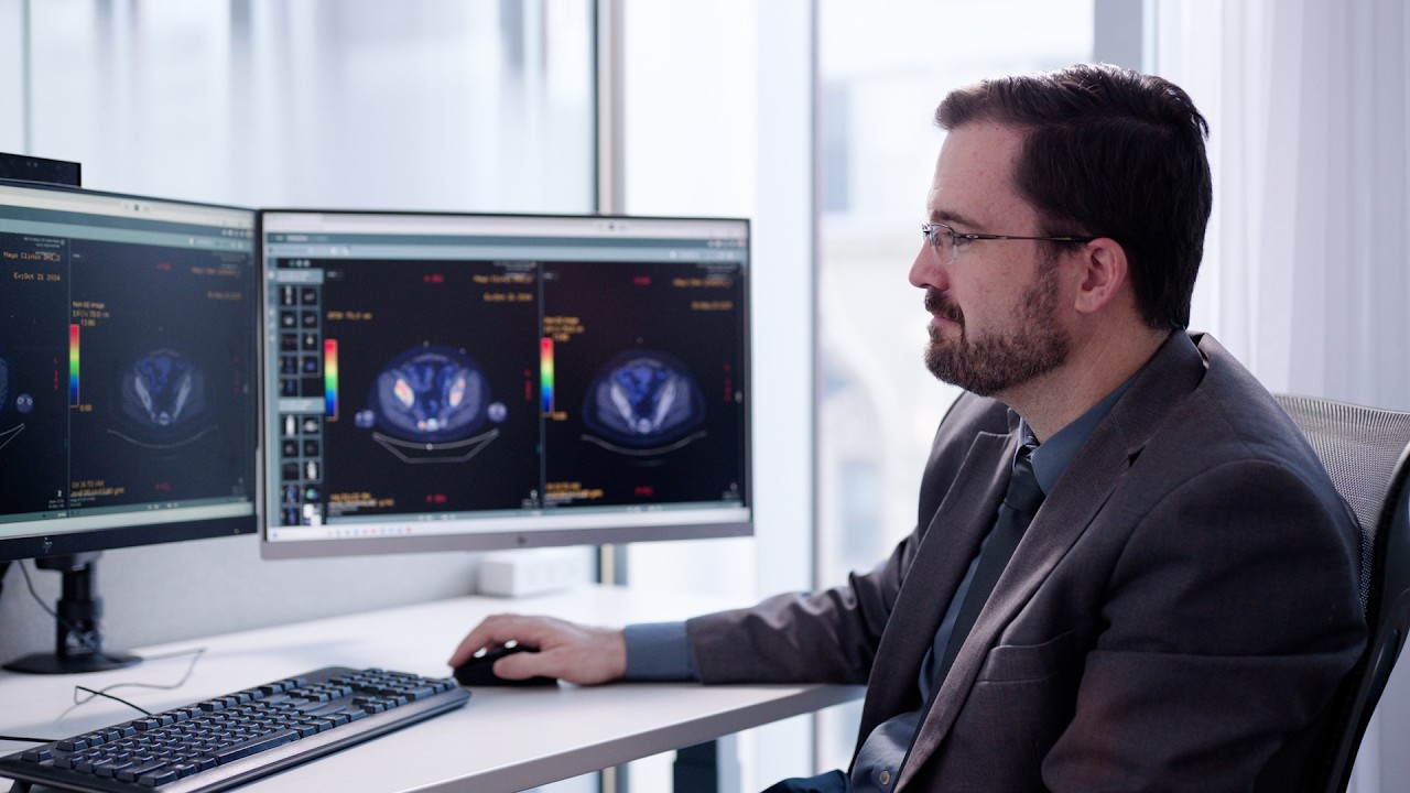 How molecular testing is transforming advanced prostate cancer care ...