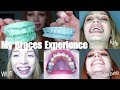 3 YEARS OF BRACES IN UNDER 30 MINS | VLOG-style experience / transformation "glow-up"