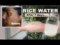 I tried rice water for 7 days  omg shocking results 