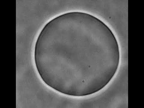 vesicle shape fluctuations or membrane thermal undulations or lipid bilayer thermal undulations