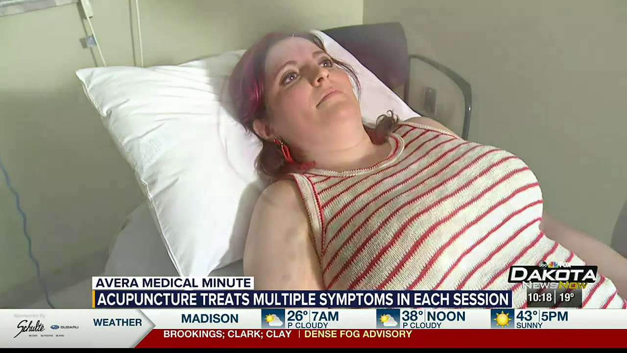 Acupuncture benefits patients by treating multiple issues in same session - Medical Minute