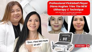 Diana Hughes Gets Lifted! | Ultherapy Prime with Dr. Alma Perez De-Leon
