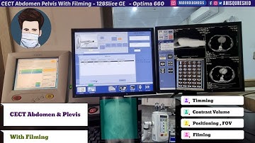 CECT Abdomen Pelvis with Filming | GE 128 Slice Optima | By Anis Qureshi