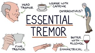 Understanding Benign Essential Tremor
