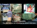 人工心肺の概要。Cardiopulmonary bypass machine. 日本語解説付き。English subtitle available.